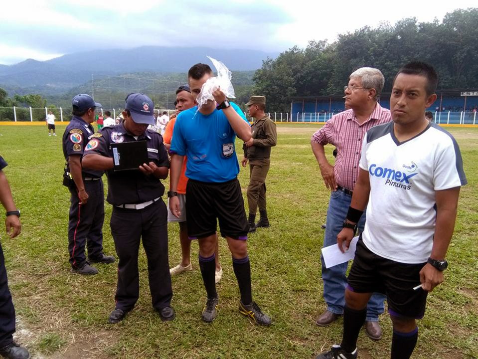 Ref held an ice pack to his injured head