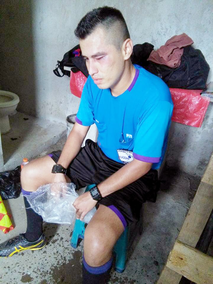 Ref Sergio Castaneda was pictured with a bruised eye after the incident