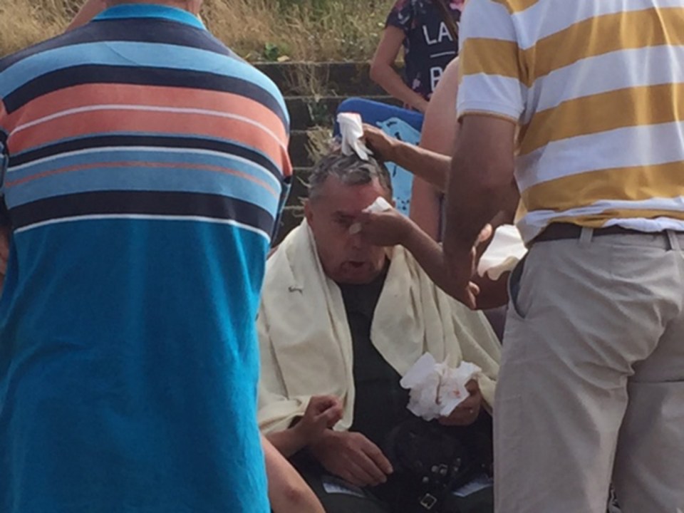 The pilot pictured being treated for his injuries after crashing into the sea while taking part in an air show