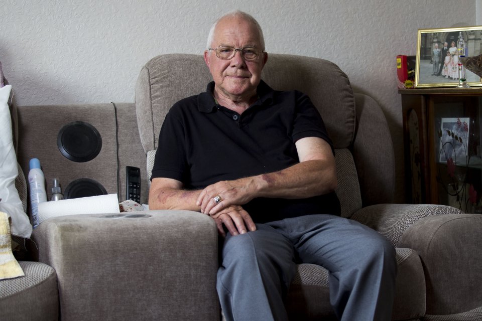 Pensioner left on trolley for 13 hours