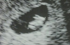 Rabbit ultrasound
