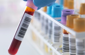 Drop of blood 'can help predict onset of Alzheimer's disease with 85% accuracy'