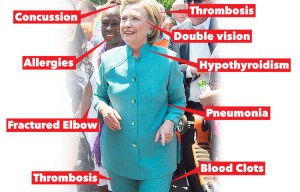 Clinton's medical history reveals three blood clots, concussion and DVT