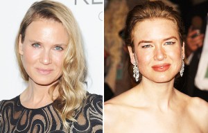 Bridget Jones star Renee Zellweger reveals real reason she looked ‘odd’ as she hits back at surgery claims