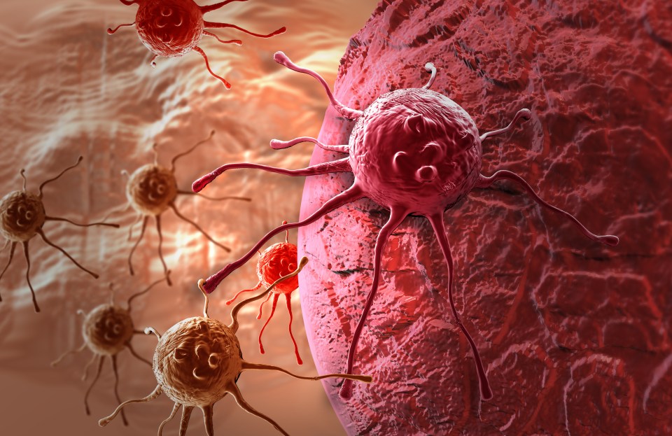 GP delay . . . skin cancer kills around 2,000 Brits each year