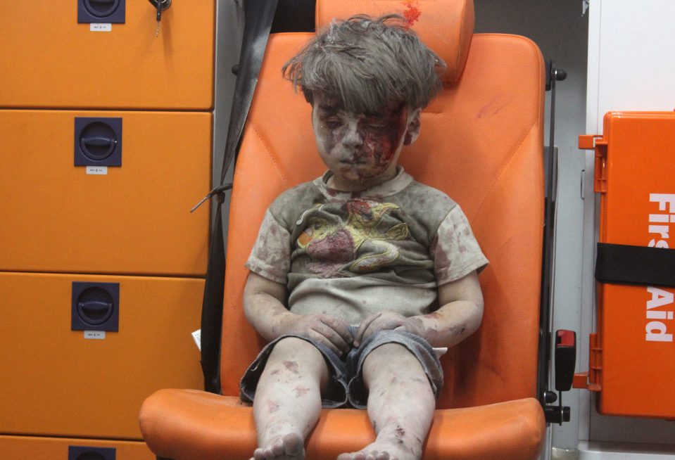 Wounded Syrian Kid Omran Daqneesh