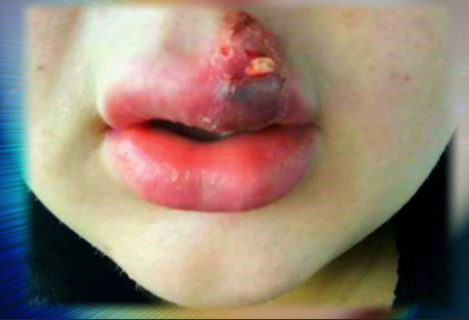 The 20-year-old's lips exploded in a shop