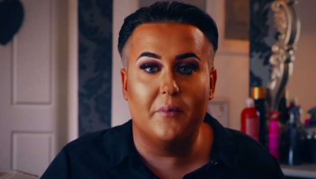 Henry was addicted to lip fillers 