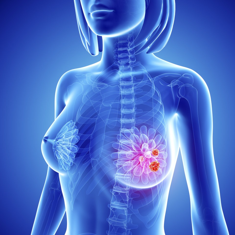 The protein switches cell function, telling cells to "eat" or kill neighbouring cells that have died. This in turn helps to reduce inflammation in the body, a known risk factor for cancer