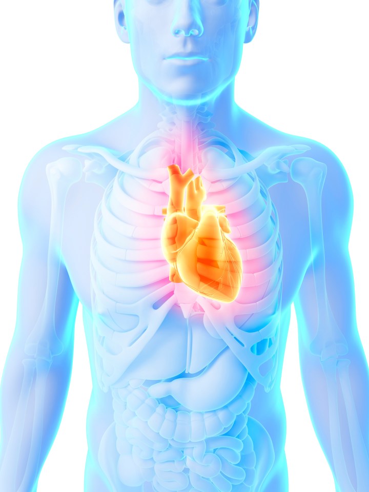 Sepsis causes more deaths than heart attack, illustrated, and any form of cancer