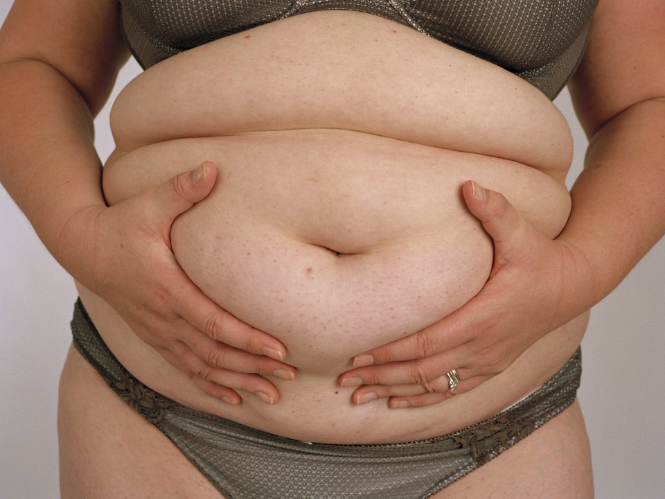 Gastric Band Treatment