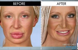 Woman who had SHEEP’S FAT injected in her lips visits the Botched docs for help with her filler fail