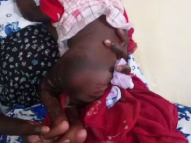 Survivors spoke of people with wounds that turned green, or children who were vomiting blood
