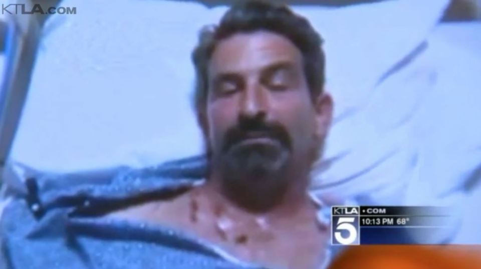 bear-attack-ktla-1