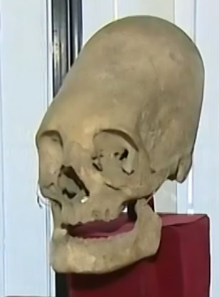 One of the mind-boggling skulls