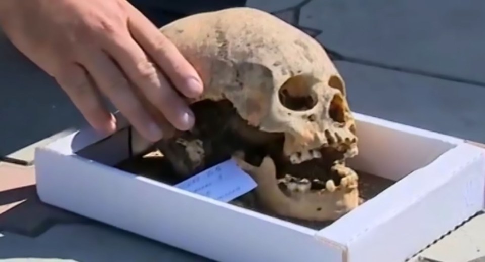 The skulls were apparently 'bound' while the people were still young