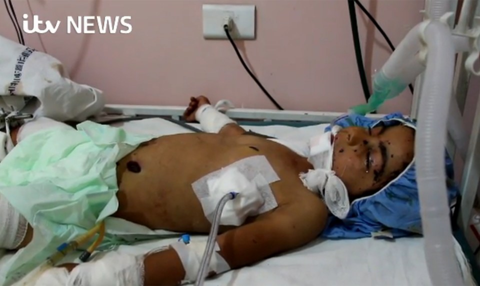 Tragic Eman lost her battle to survive after she picked up a cluster bomb she believed to be a toy in Aleppo