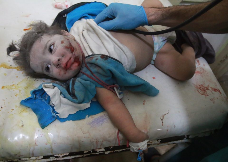 A baby covered in dust stares at his rescuers while being treated by medics 