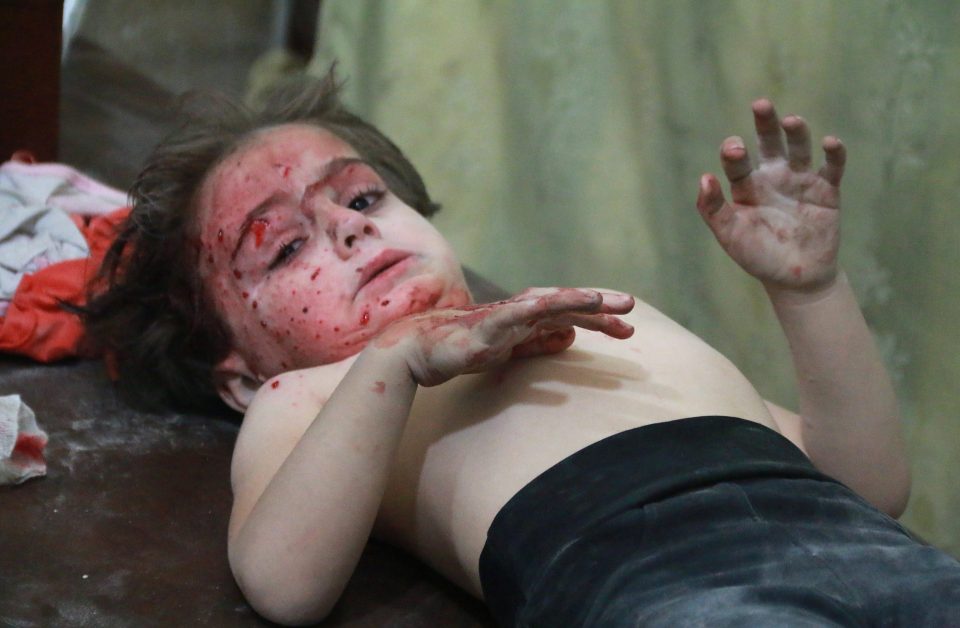 A wounded Syrian child gets treatment at a field hospital following the airstrikes