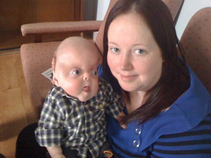 Inspirational Little Boy With Rare Genetic Disorder Defies The Odds Of Condition