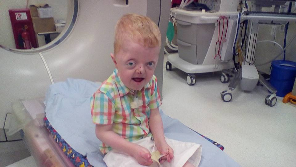 Inspirational Little Boy With Rare Genetic Disorder Defies The Odds Of Condition
