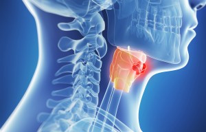 Oral sex can cause mouth and throat cancer - and the HPV virus is to blame