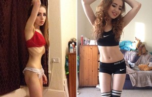 Anorexic teen who survived on just one bagel A DAY discusses journey to save her life