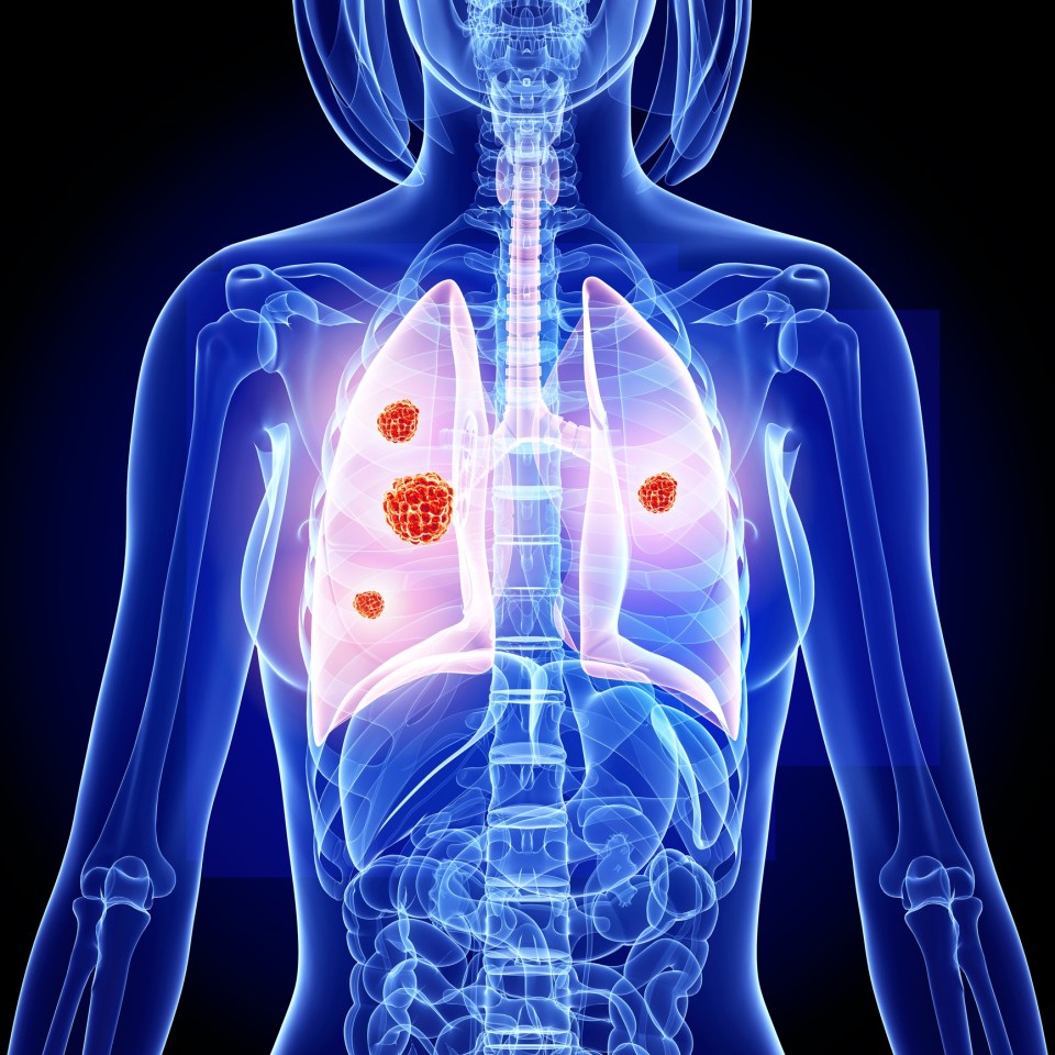 Researchers found found the production of toxic aldehydes, known to raise the risk of cancer, “is exponentially dependent on the concentration of flavouring compounds”