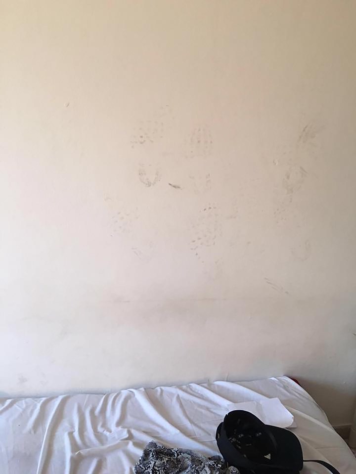 CLUB 18-30 HOLIDAYMAKER WHO CAUGHT PNEUMONIA FROM FILTHY ROOM HIT WITH 3K BILL - DESPITE HAVING INSURANCE