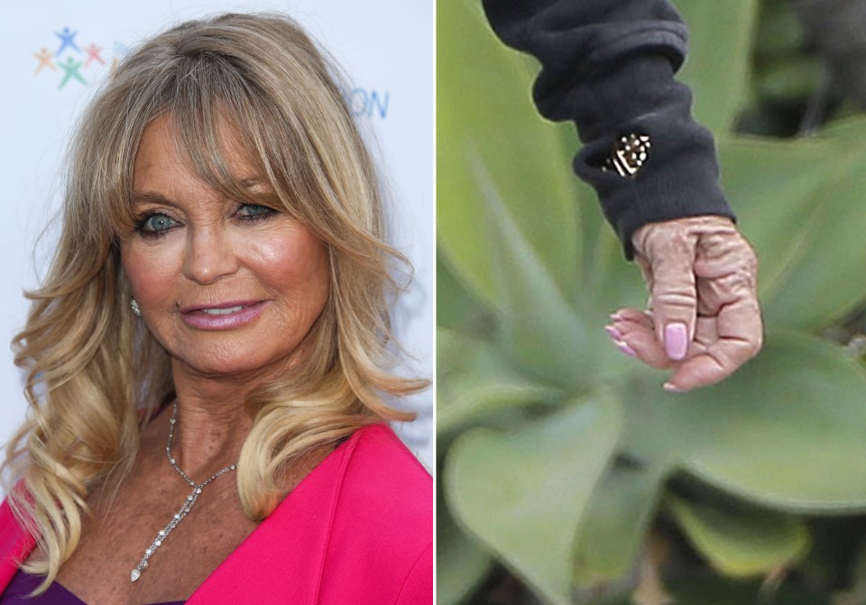  Goldie Hawn could still pass for 59 but her hands are spot on 70