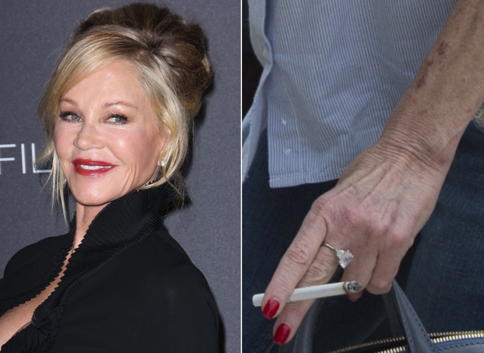  Mel could pass for 49 but her hand age is 60