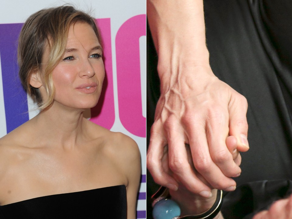  Renee still looks 42 but her hands right for her age of 47