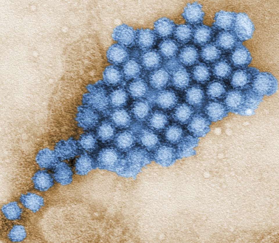 Norovirus, also known as the winter vomiting bug, affects 685million people across the world every year, triggering vomiting and diarrhoea