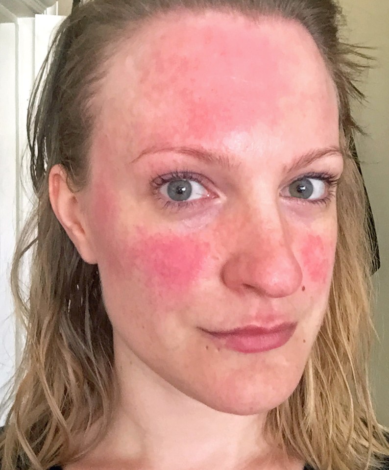 Lex Gillies, from Canning Town, was left mortified at work when pals assumed she fancied her boss when she went red-faced talking to him