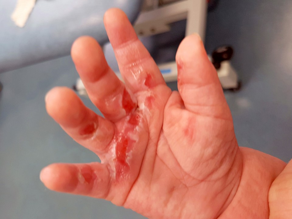 The tot, who has recently begun to crawl, grabbed the pipe while his mum wasn't looking
