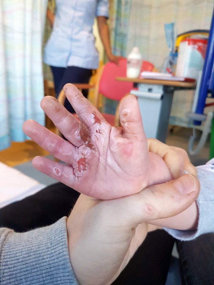 He was taken to hospital and referred to a plastic surgeon