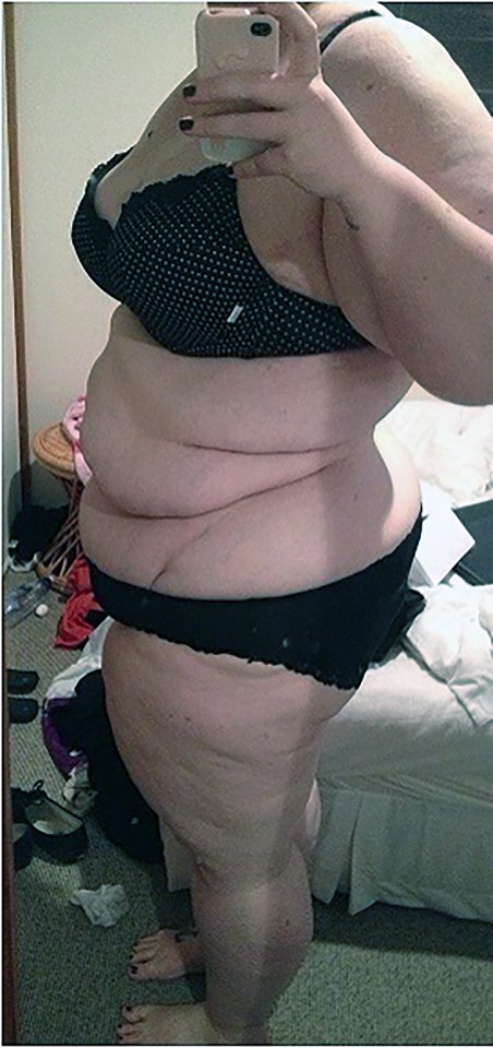 Elora said her eating problems became worse after she lost her dad to cancer when she was 10-years-old