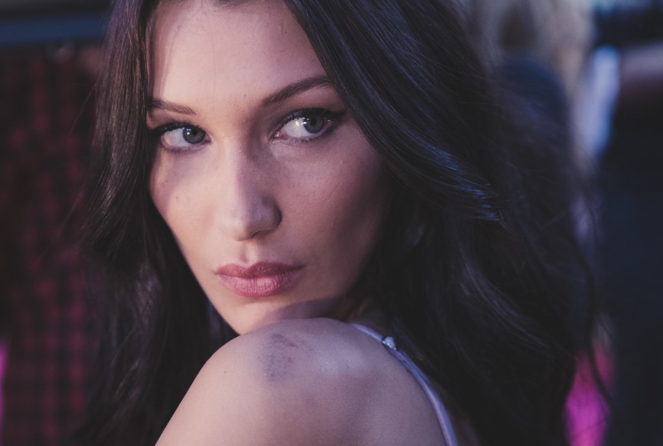 Bella Hadid showed off a painful bruised shoulder ahead of the Victoria's Secret Fashion Show