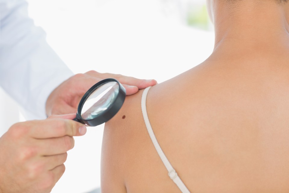 Experts said other forms of alcohol, including beer, red wine and hard spirits, did not significantly affect a person's melanoma risk