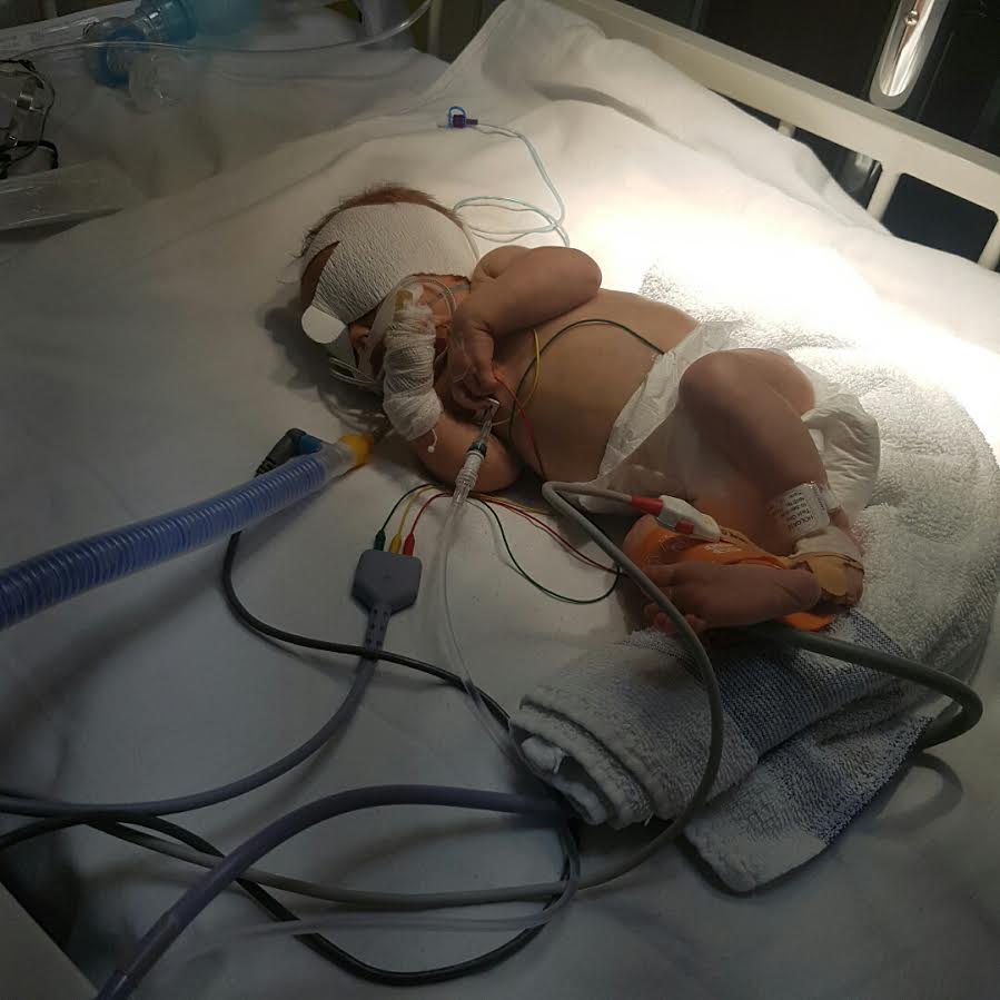 Nancy was covered in tubes while she was treated for the illness in hospital