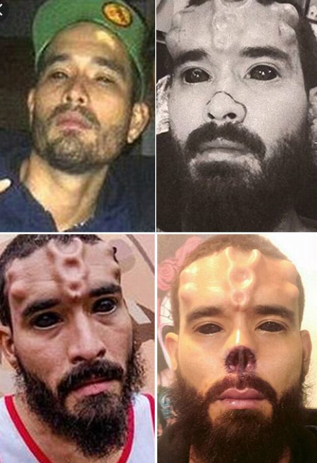 Before Henry was allowed to undergo the body modification he had to complete a number of physical and psychological tests, which he passed says Emilio