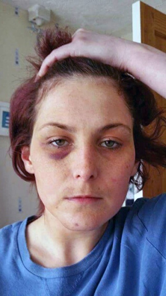 MUM SPEAKS OUT AFTER EX TORTURED HER IN THREE HOUR ATTACK