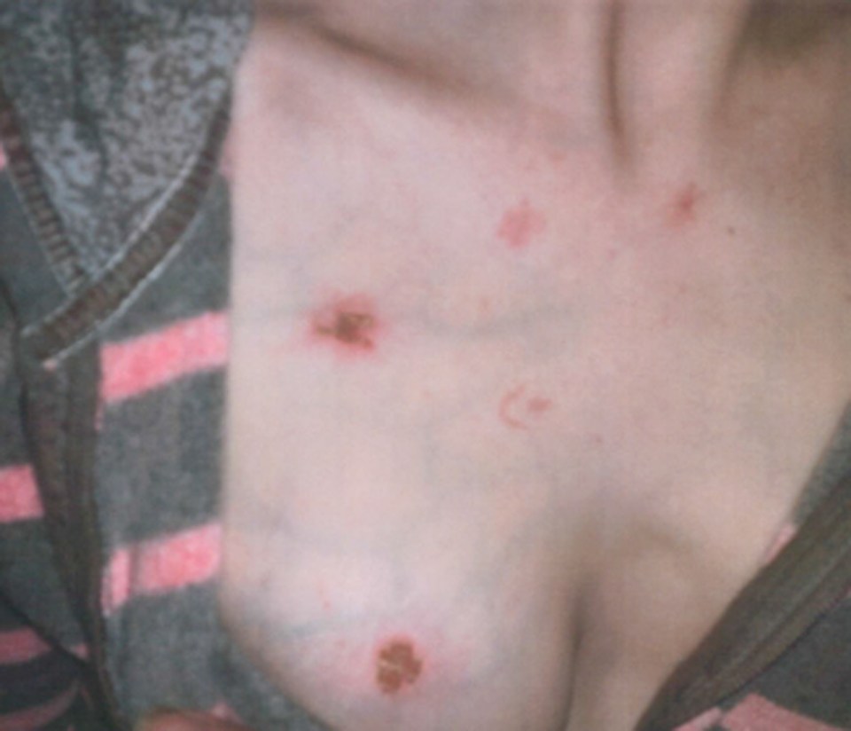 MUM SPEAKS OUT AFTER EX TORTURED HER IN THREE HOUR ATTACK