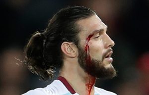 Andy Carroll bloodied but unbowed after suffering cut eyebrow in West Ham draw at Anfield