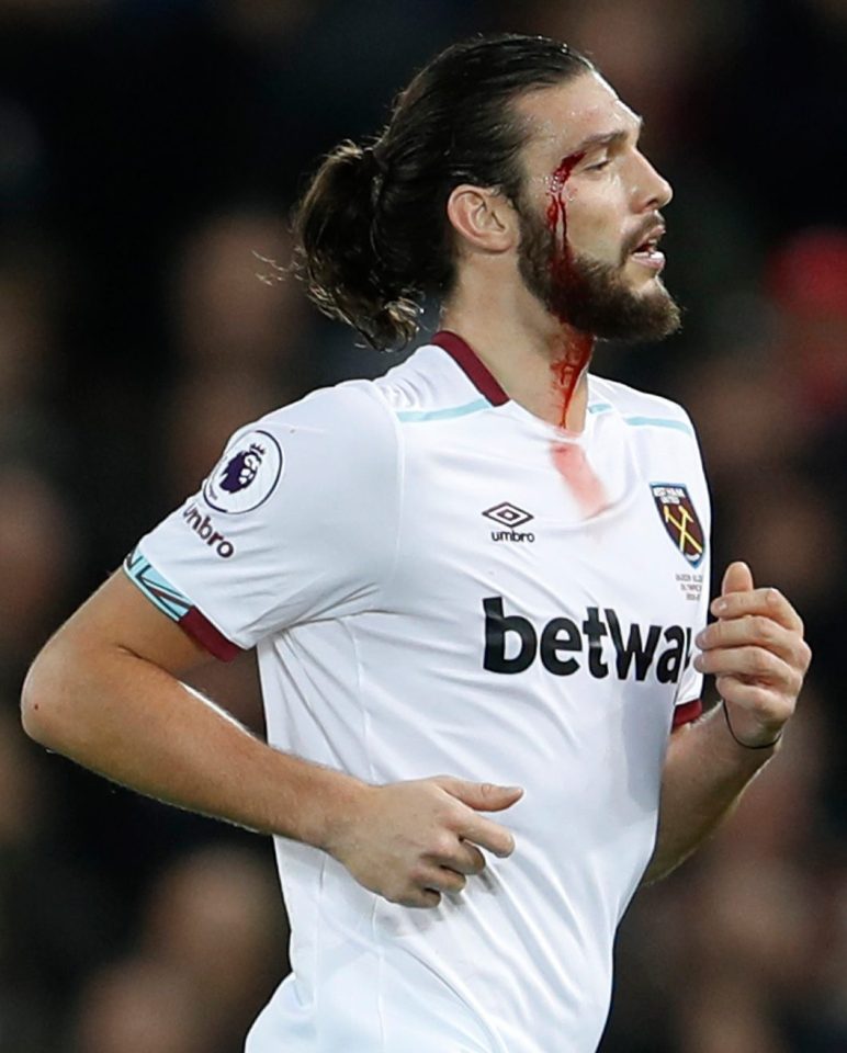 Andy Carroll came on for the last half hour and picked up a cut to the face