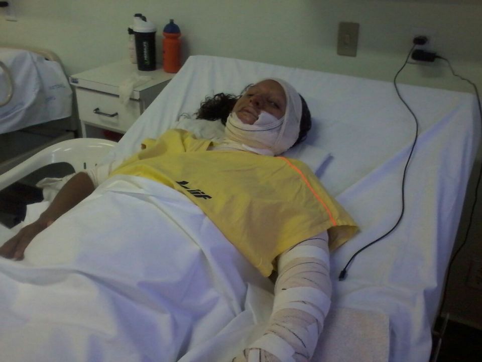 Maria, who works as a waitress, was offered the new therapy over traditional methods of treating burn wounds