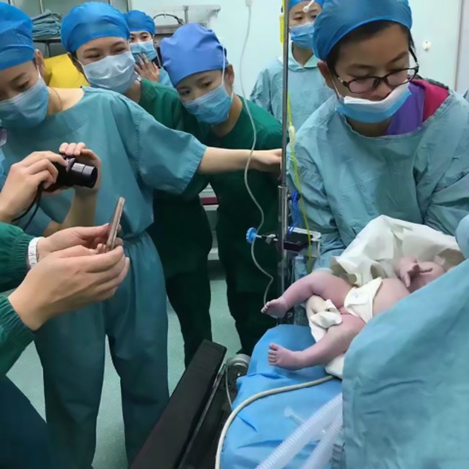 The woman's baby girl was delivered by C-section, after experts managed to get her mum ready for surgery 