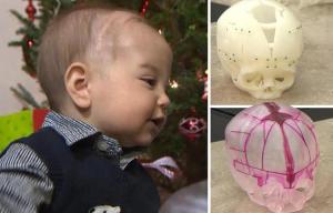 composite 3D printed skull