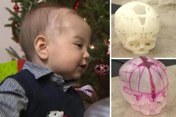 composite 3D printed skull
