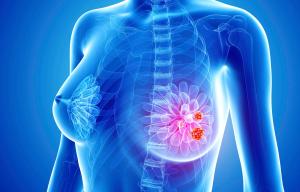 Scientists discover 23 genes that 'control how cancer invades the body - raising hopes of a cure'